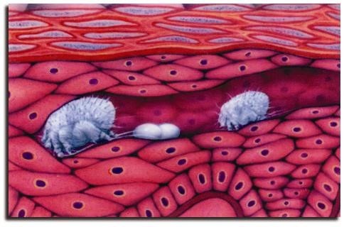 豬疥螨病的診斷和防控方案